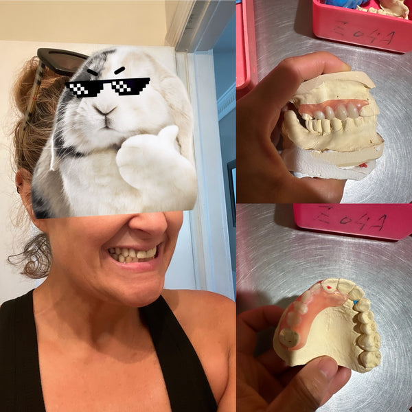 Permanently Flexible/TCS partial denture *Impression kit included*