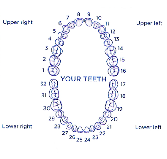 Flipper, Partial denture Impression Kit