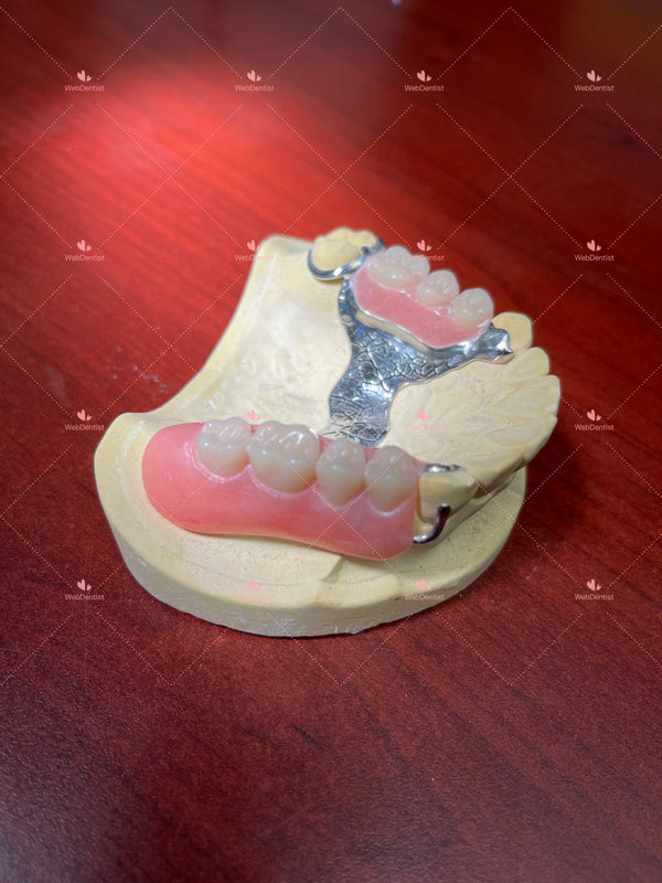 Permanently  Custom Made High Quality Upper/Lower Partial Denture w/Metal *Impression kit INCLUDED*