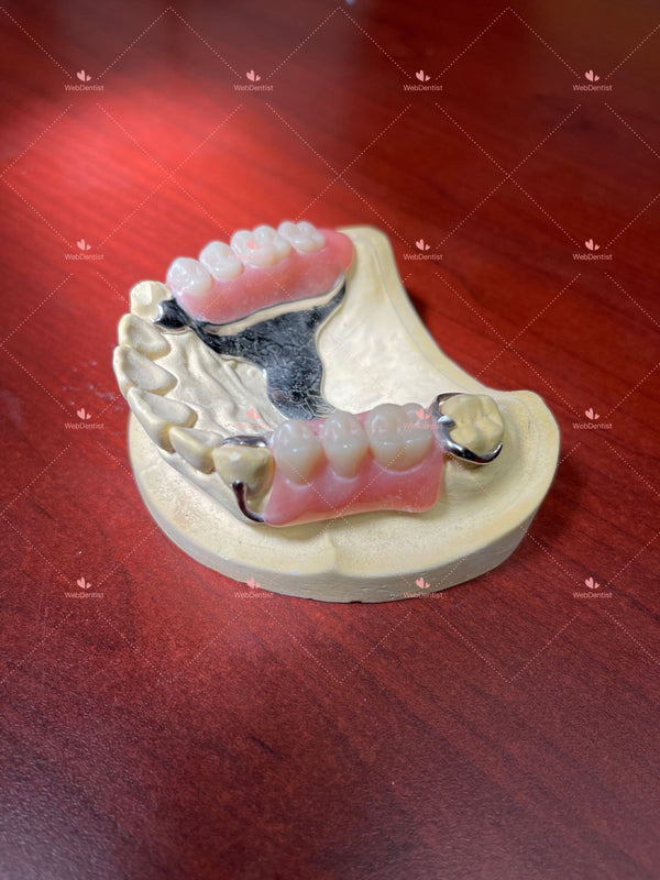 Permanently  Custom Made High Quality Upper/Lower Partial Denture w/Metal *Impression kit INCLUDED*