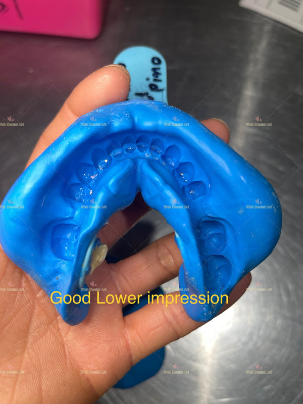 Flipper, Partial denture Impression Kit