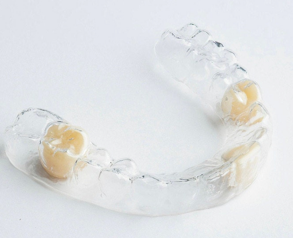 Clear Orthodontic Retainer| Clear Aligners (Impression kit included)