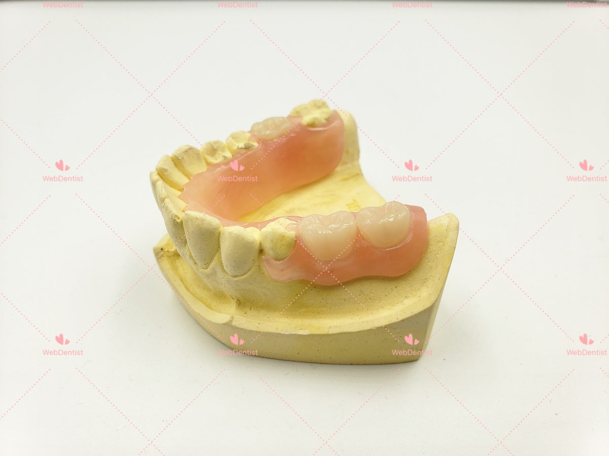 Permanently Flexible/TCS partial denture *Impression kit not included ...