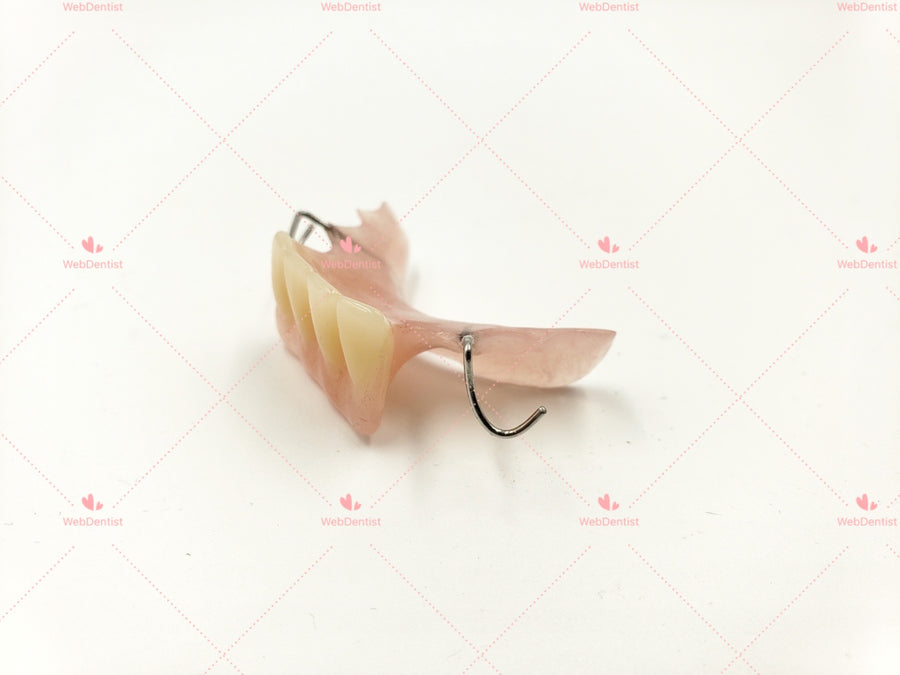 Flipper/Stayplate Partial Denture (acrylic material) *Impression kit I ...