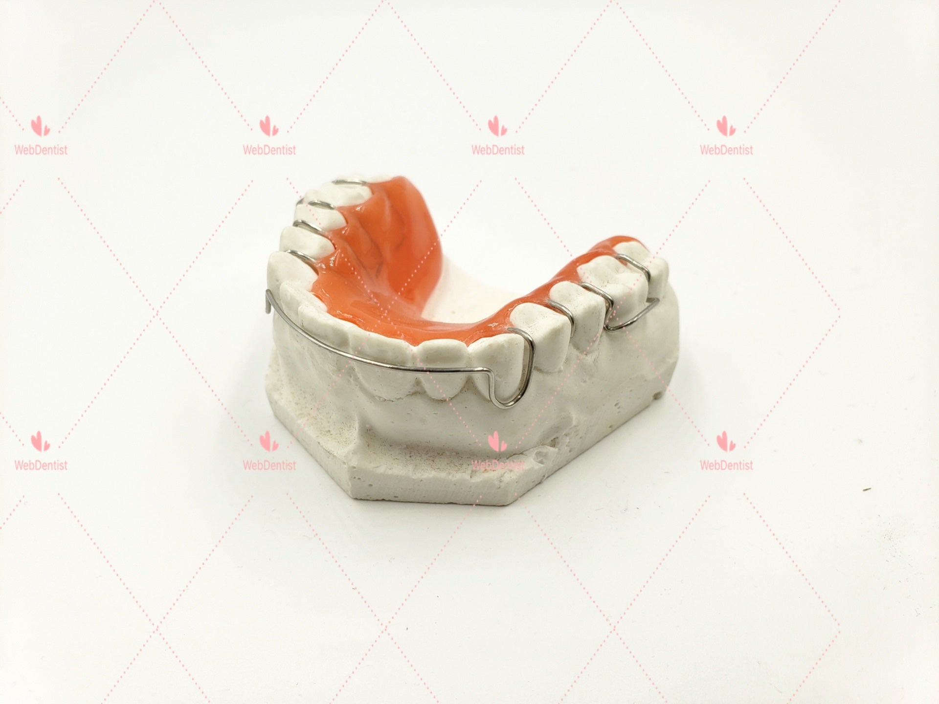 Hawley Retainer (Impression kit included) – WebDentalArt