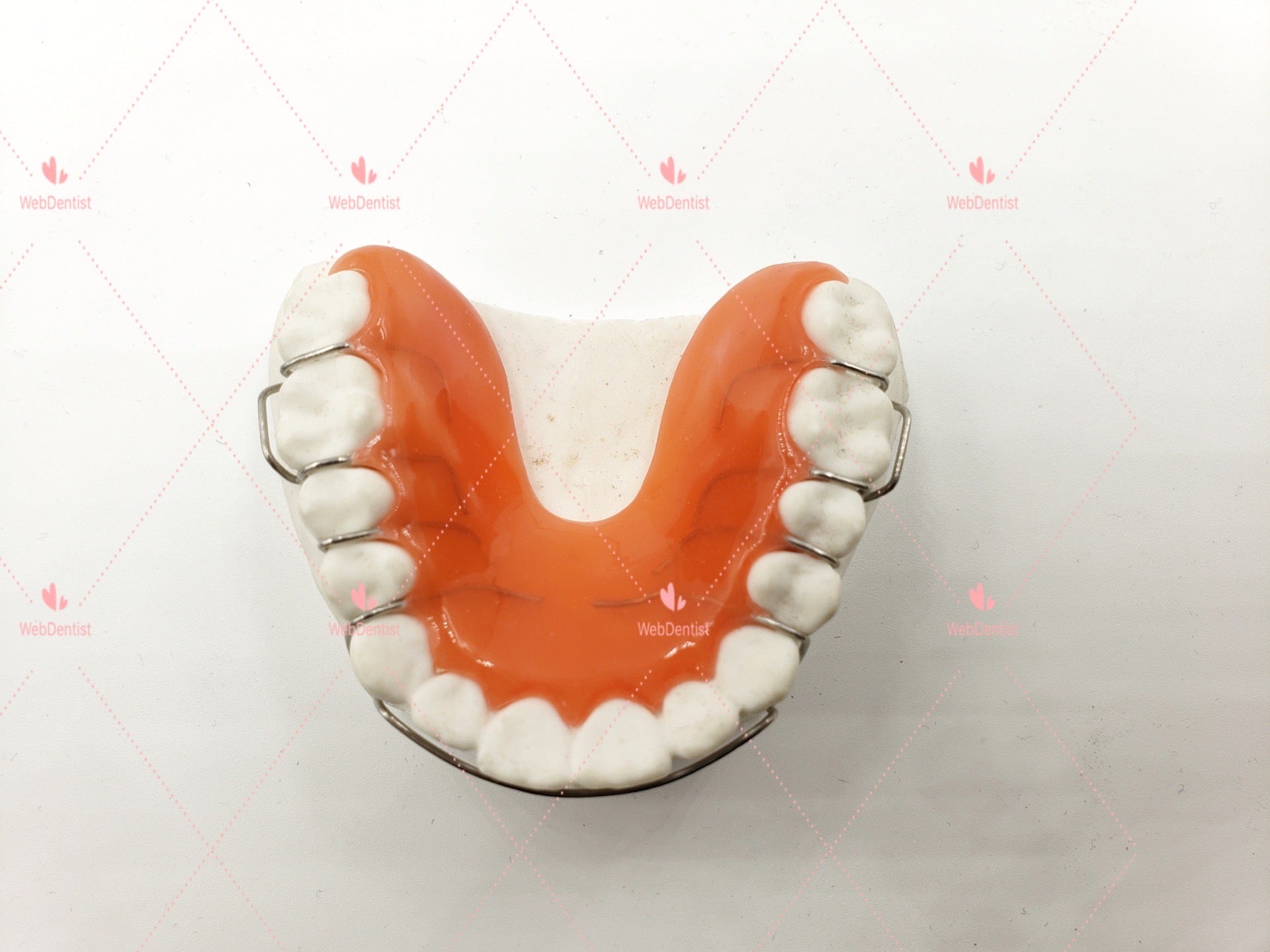 Hawley Retainer (Impression kit included) – WebDentalArt