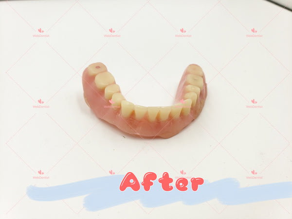 Professional Denture & Partial Repair for existing partial denture