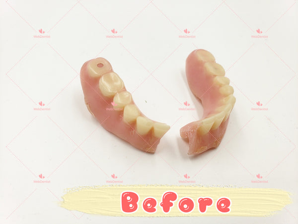 Professional Denture & Partial Repair for existing partial denture