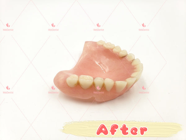 Professional Denture & Partial Repair for existing partial denture