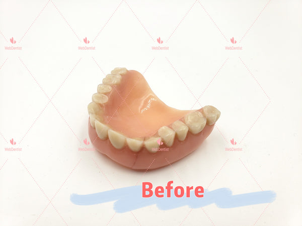 Professional Denture & Partial Repair for existing partial denture