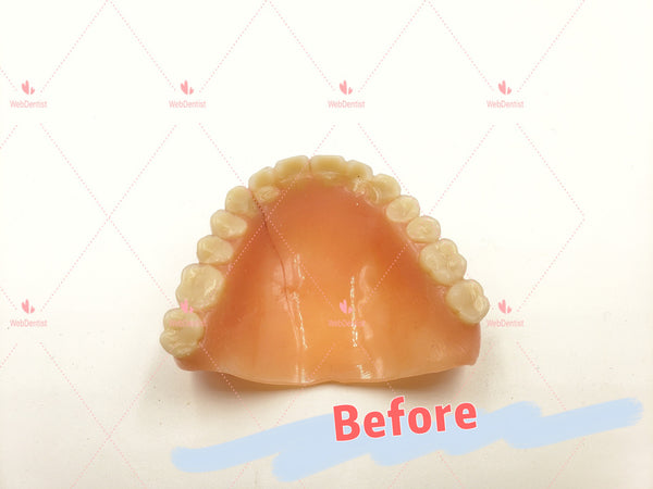 Professional Denture & Partial Repair for existing partial denture