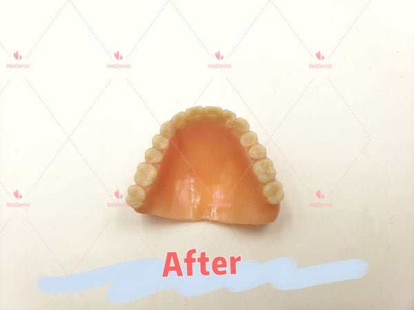 Professional Denture & Partial Repair for existing partial denture