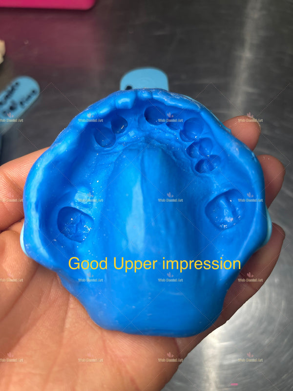 Flipper, Partial denture Impression Kit