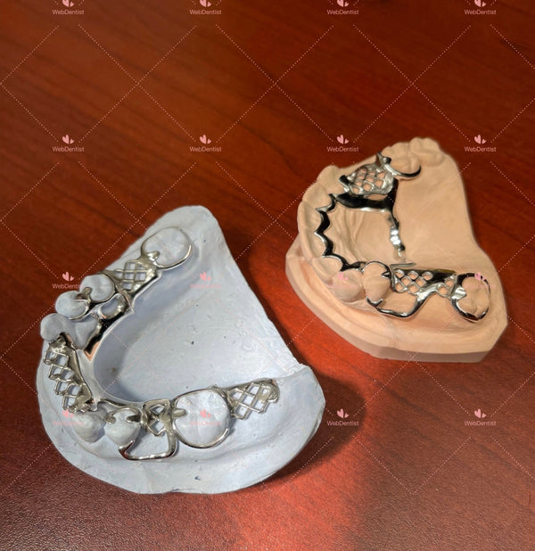 Permanently  Custom Made High Quality Upper/Lower Partial Denture w/Metal *Impression kit not included*